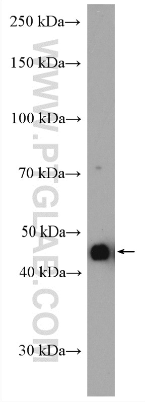 WB analysis of HeLa using 23045-1-AP