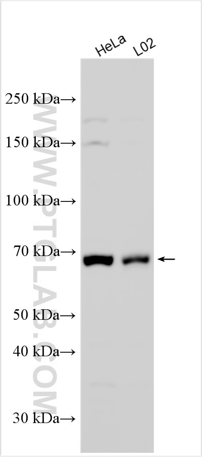 Western Blot (WB) analysis of various lysates using OXTR Polyclonal antibody (23045-1-AP)