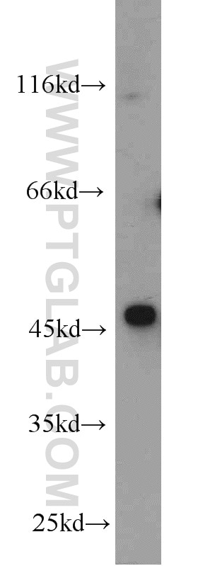 Western Blot (WB) analysis of Jurkat cells using OXTR Polyclonal antibody (23045-1-AP)