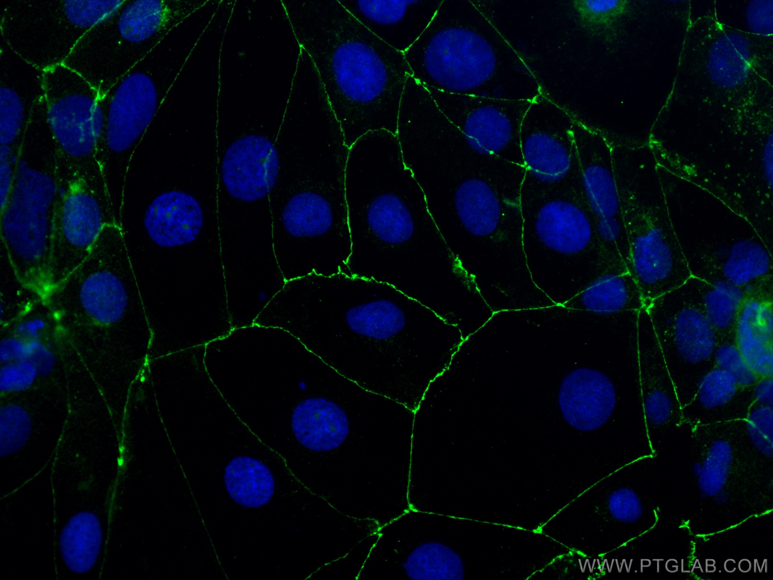 Immunofluorescence (IF) / fluorescent staining of Caco-2 cells using Occludin Polyclonal antibody (27260-1-AP)