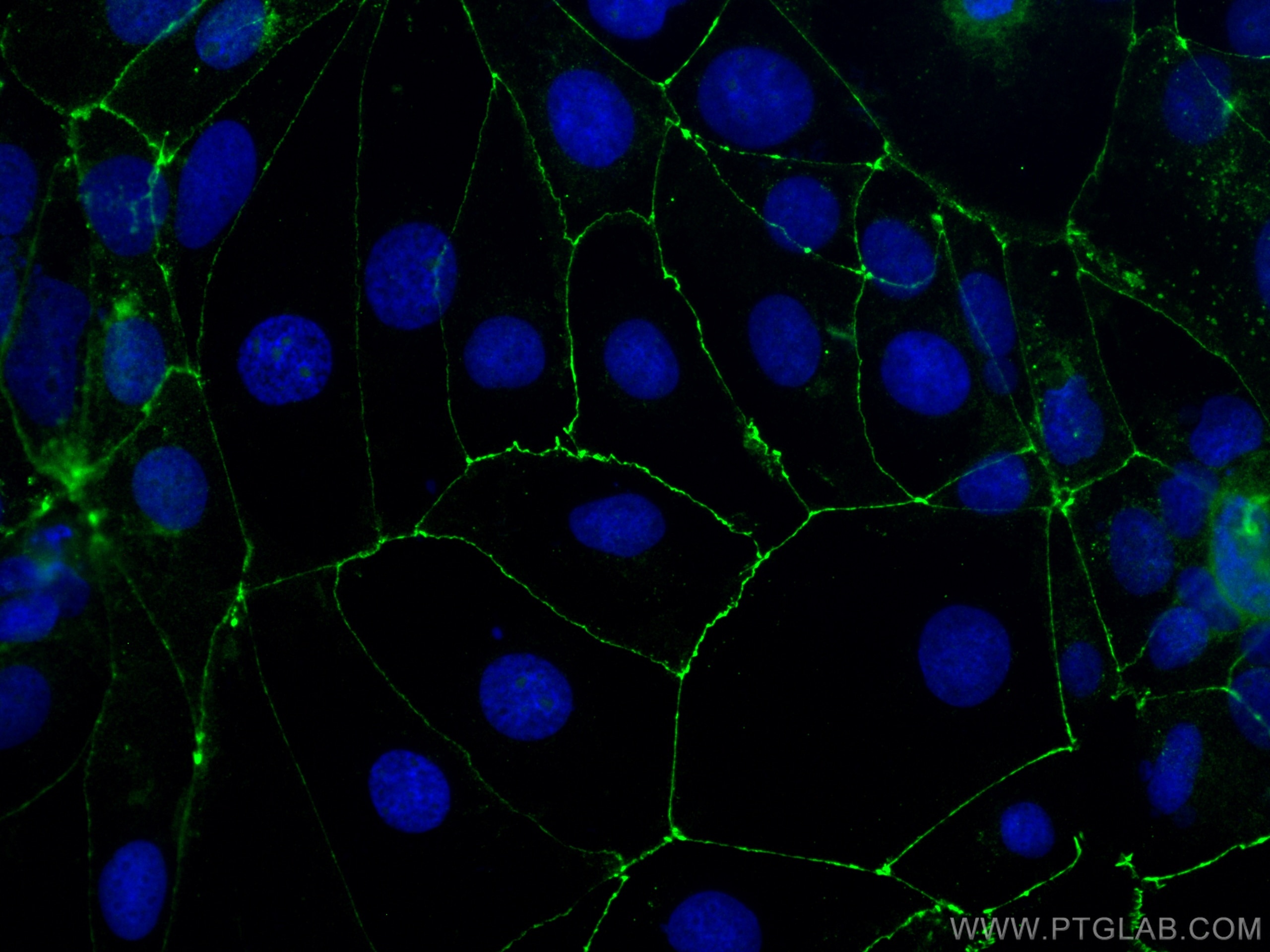 IF Staining of Caco-2 using 27260-1-AP