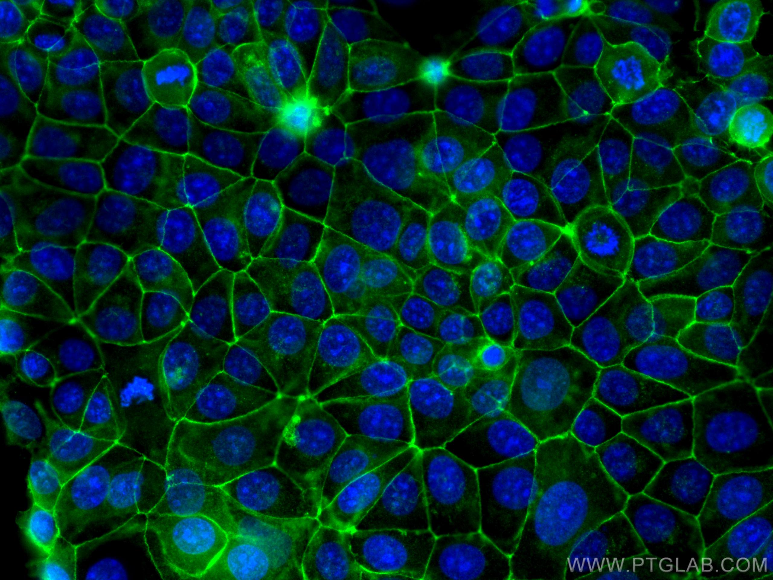 Immunofluorescence (IF) / fluorescent staining of MCF-7 cells using Occludin Polyclonal antibody (27260-1-AP)