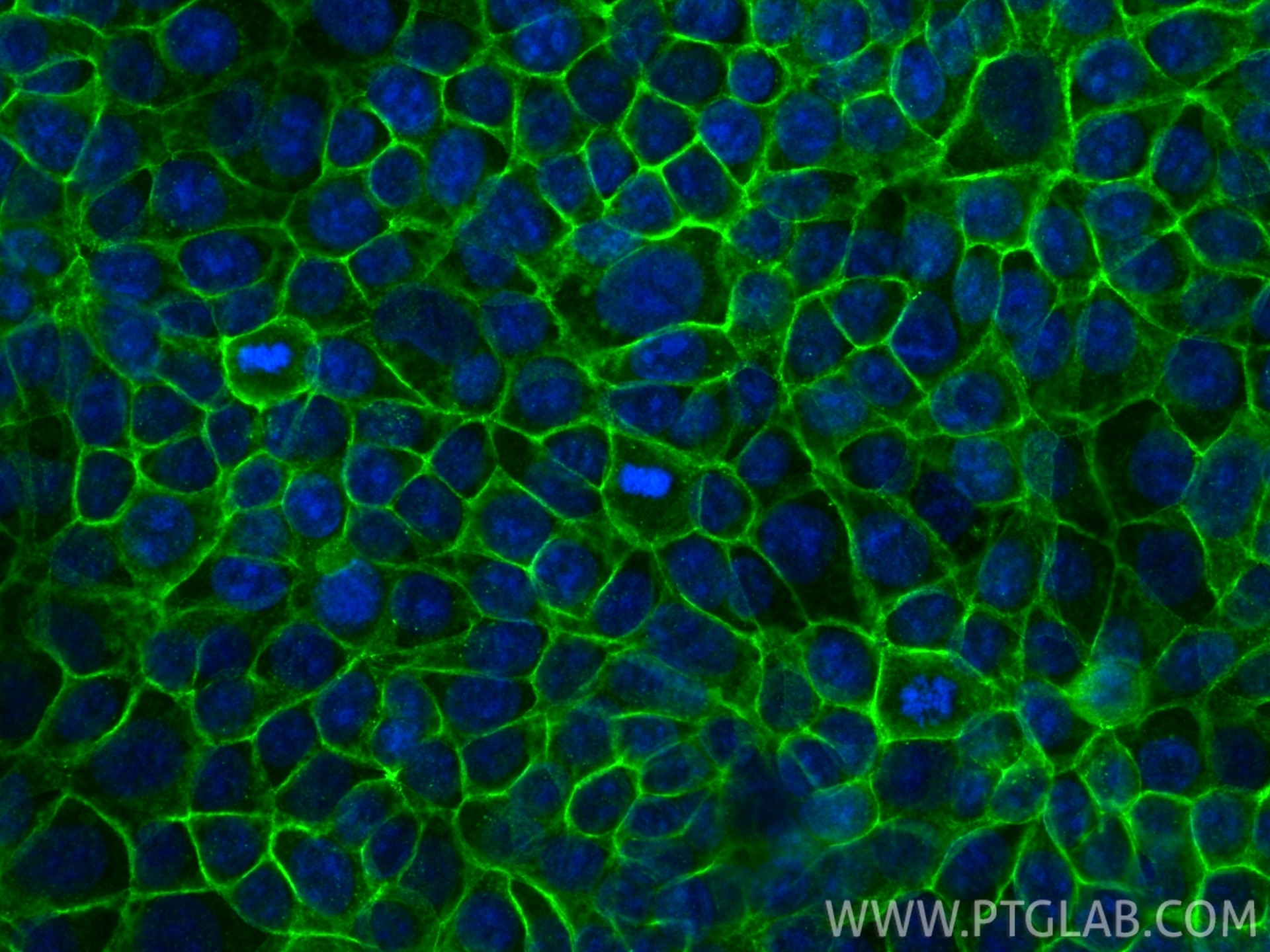 Immunofluorescent analysis of (-20°C Methanol) fixed MCF-7 cells using Occludin antibody (27260-1-AP) at dilution of 1:400 and CoraLite®488-Conjugated Goat Anti-Rabbit IgG(H+L) (SA00013-2). Immunofluorescence (IF) / fluorescent staining of MCF-7 cells using Occludin Polyclonal antibody (27260-1-AP)