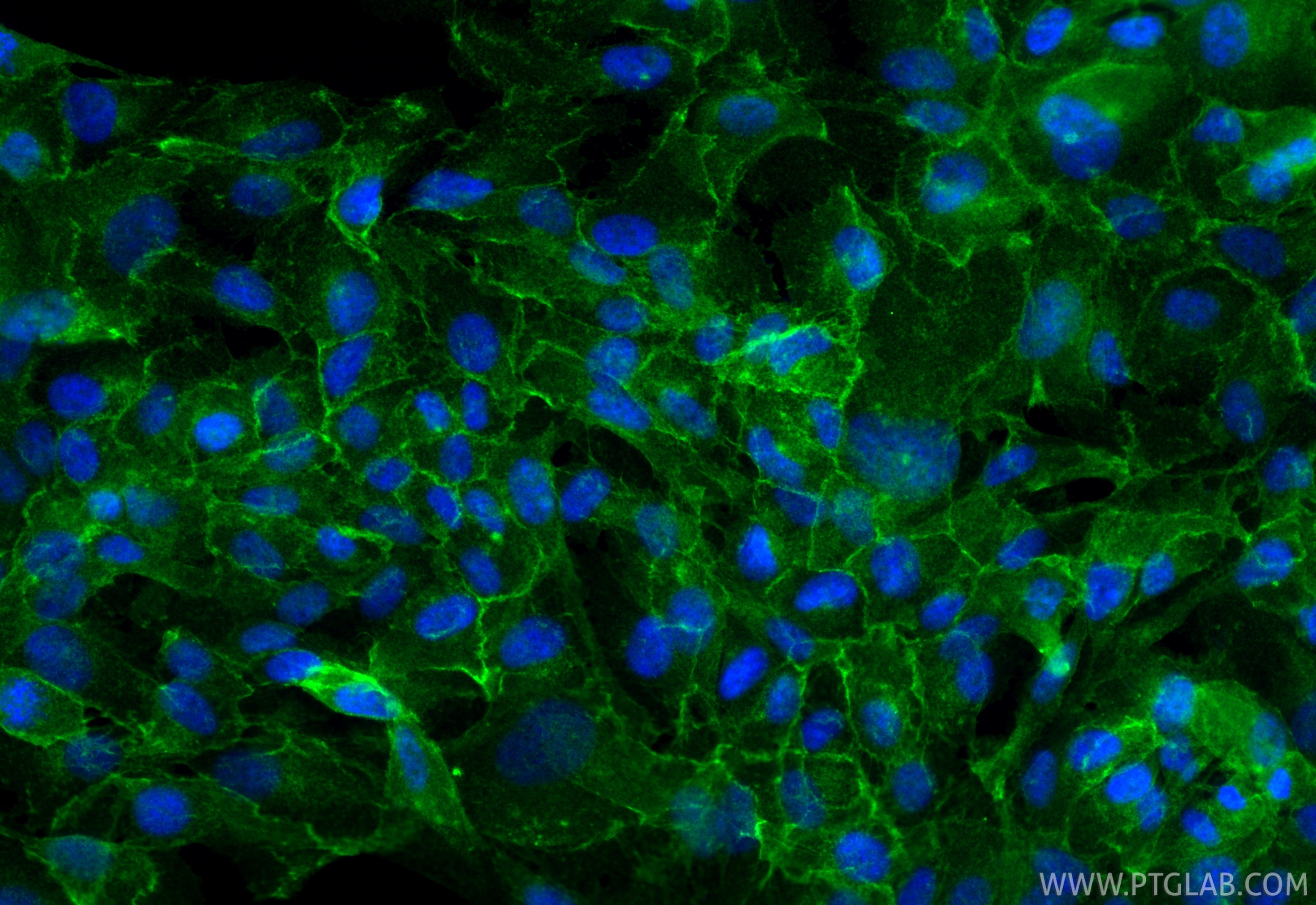 Immunofluorescence (IF) / fluorescent staining of hTERT-RPE1 cells using Occludin Polyclonal antibody (27260-1-AP)