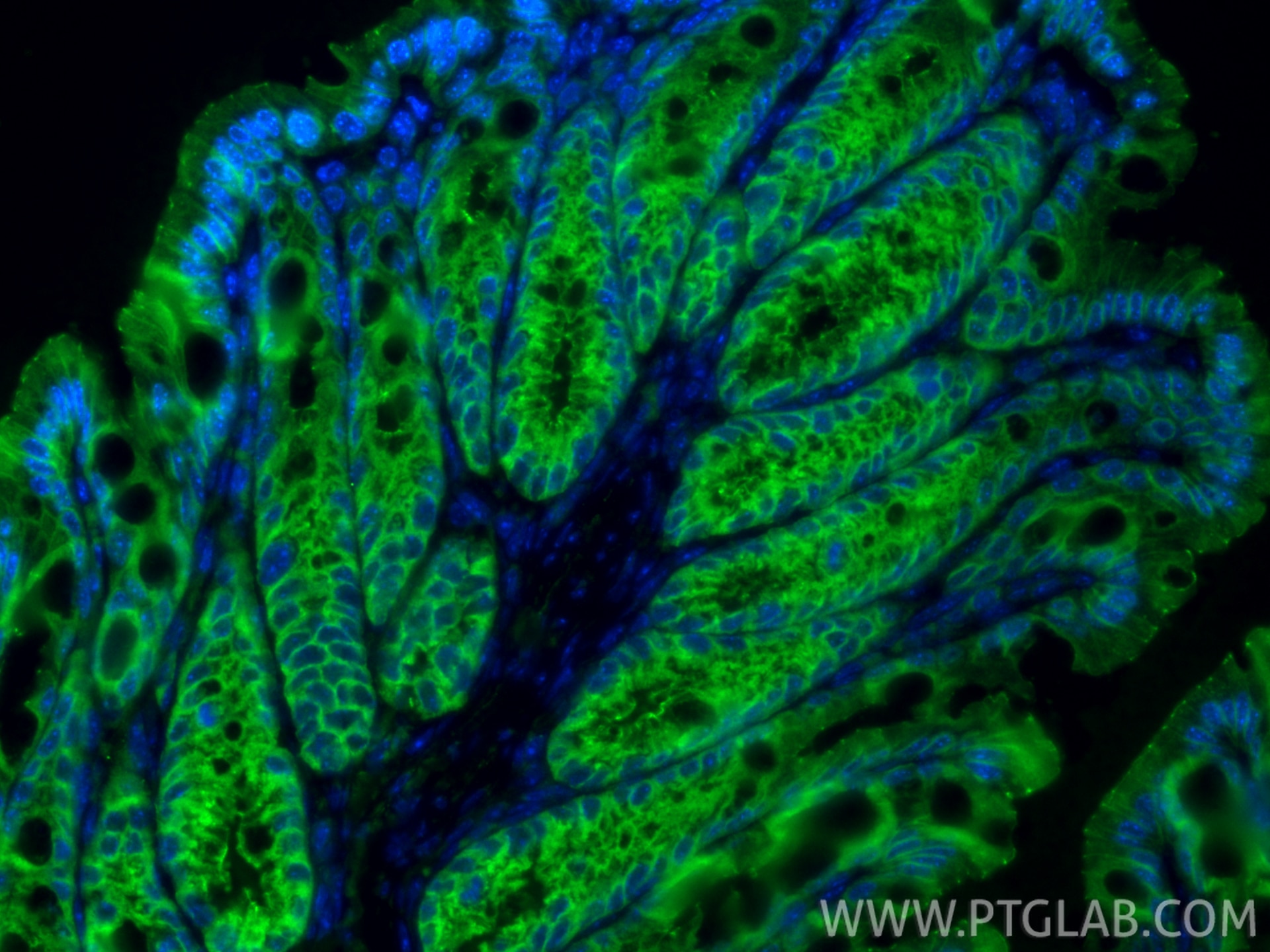 IF Staining of mouse colon using 27260-1-AP Immunofluorescence (IF) / fluorescent staining of mouse colon tissue using Occludin Polyclonal antibody (27260-1-AP)