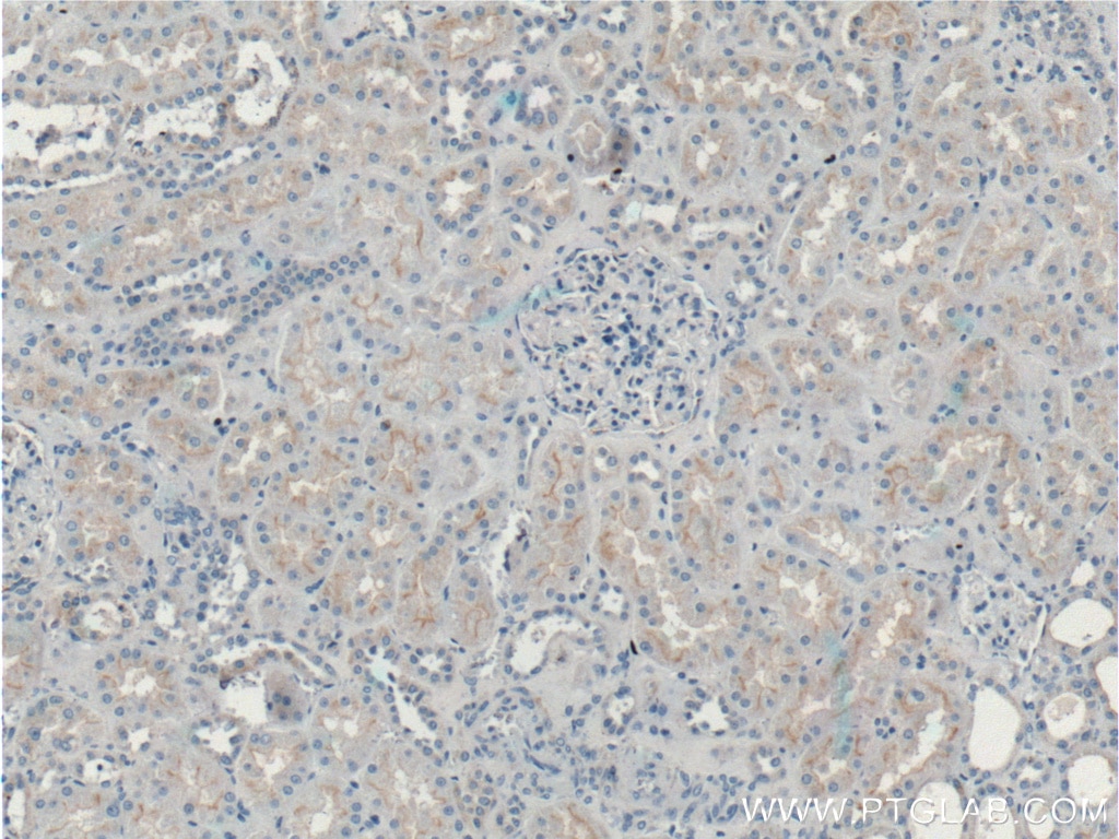 Immunohistochemistry (IHC) staining of human kidney tissue using Occludin Polyclonal antibody (27260-1-AP)
