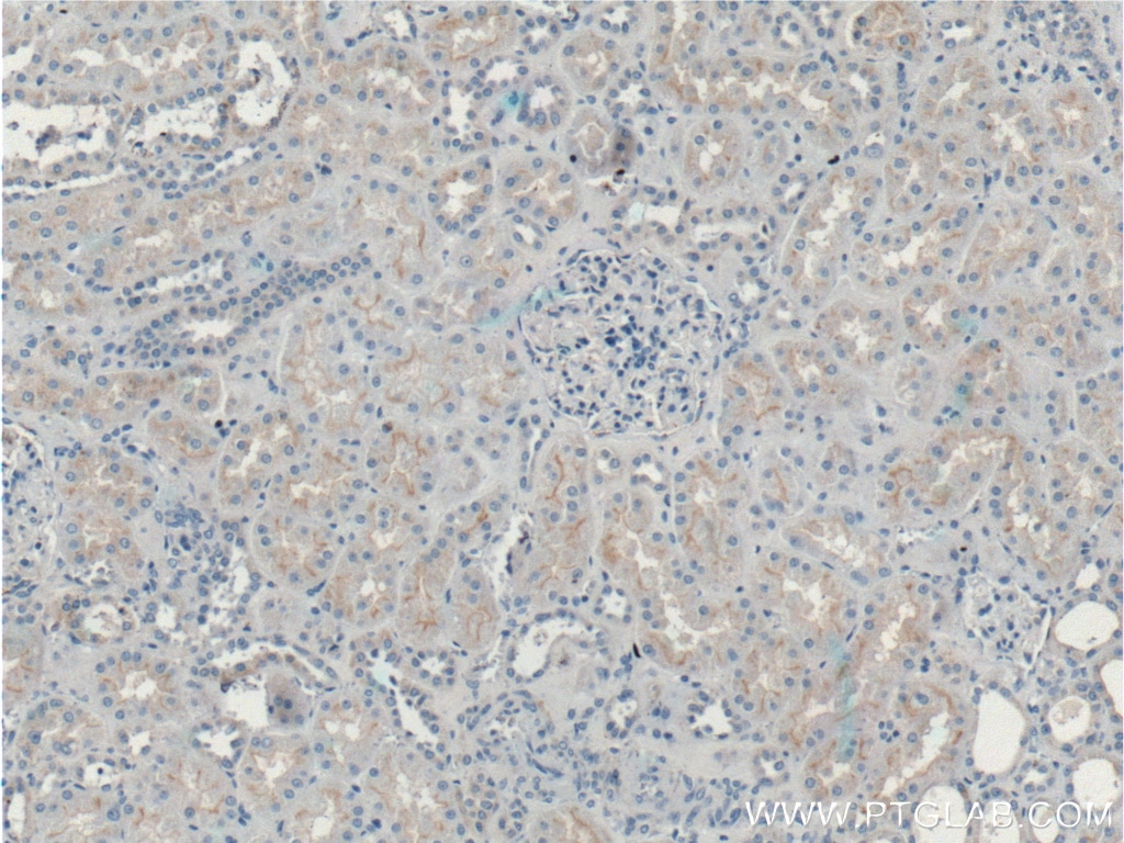 IHC staining of human kidney using 27260-1-AP