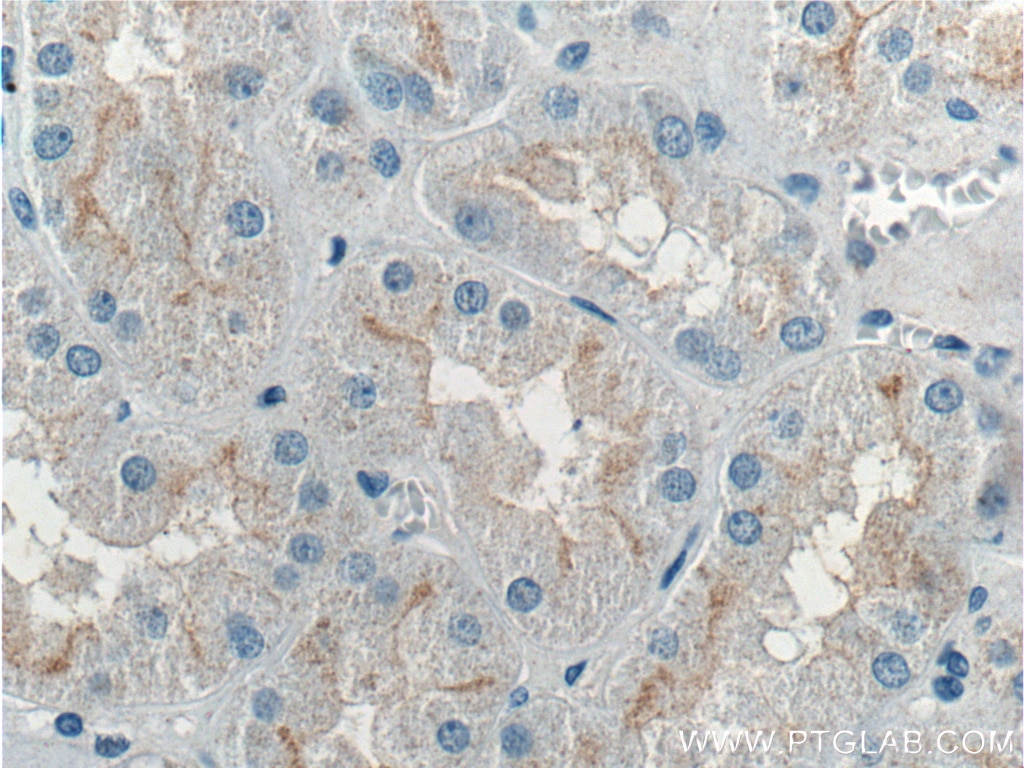 Immunohistochemistry (IHC) staining of human kidney tissue using Occludin Polyclonal antibody (27260-1-AP)