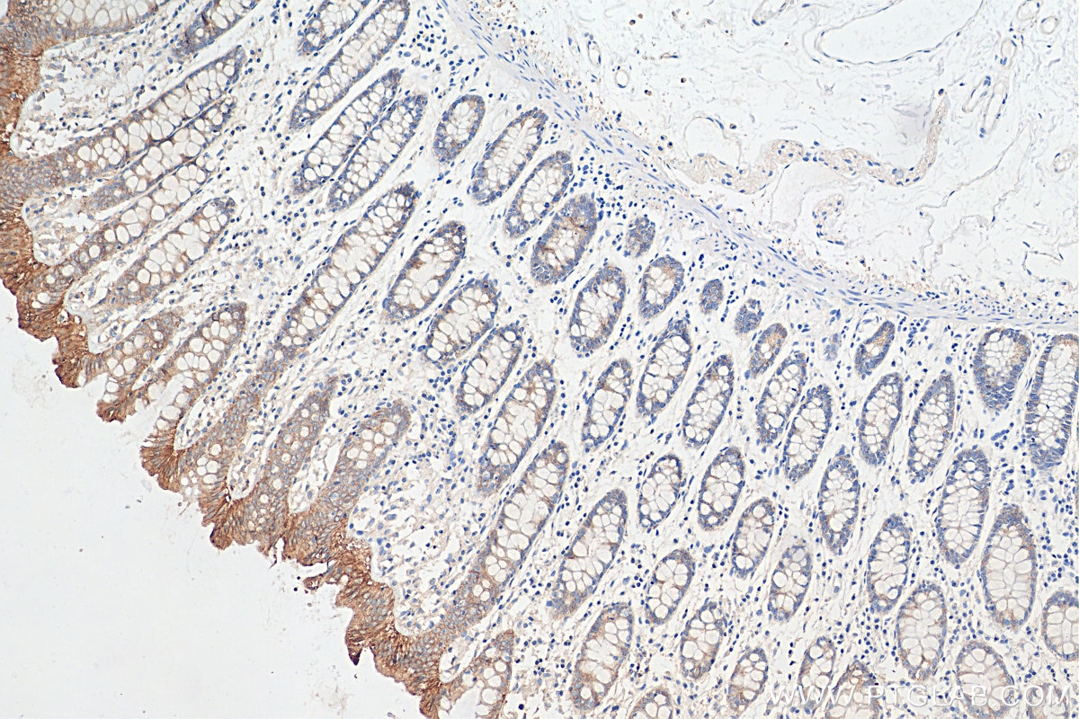 Immunohistochemistry (IHC) staining of human colon tissue using Occludin Polyclonal antibody (27260-1-AP)
