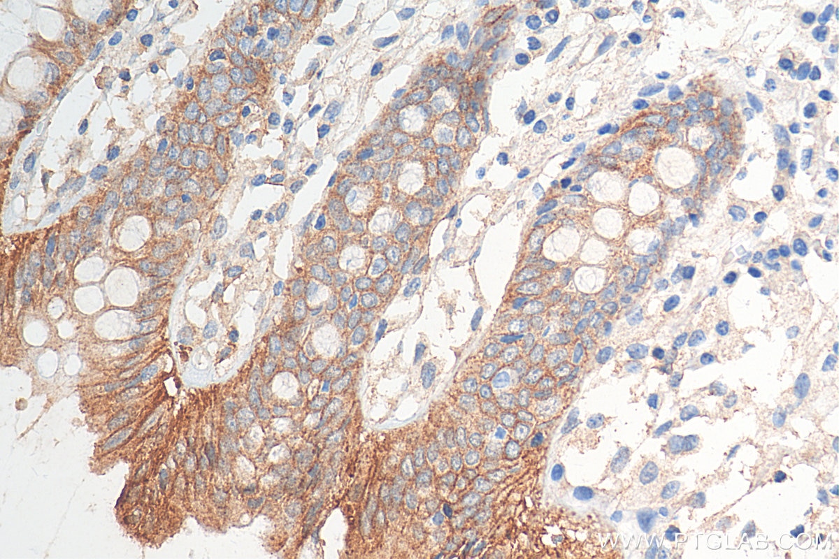 Immunohistochemistry (IHC) staining of human colon tissue using Occludin Polyclonal antibody (27260-1-AP)