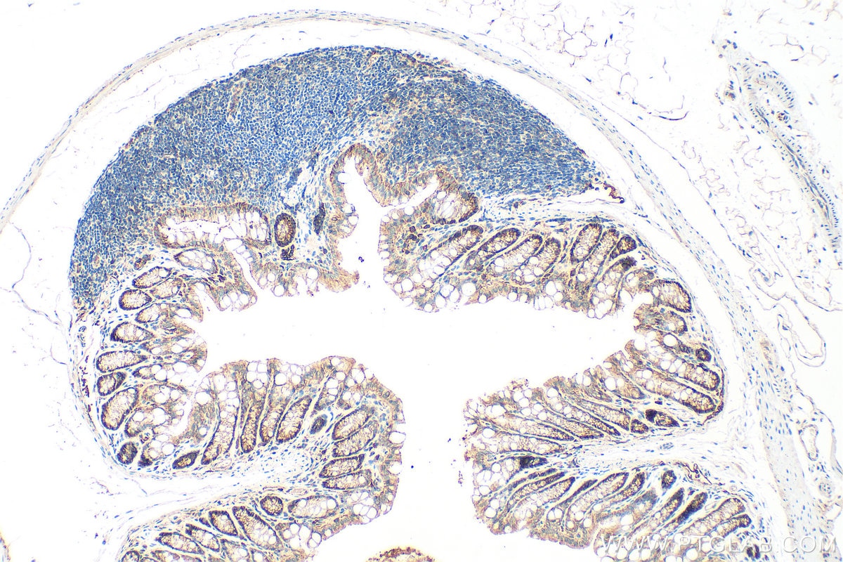 Immunohistochemical analysis of paraffin-embedded mouse colon tissue slide using 27260-1-AP (Occludin antibody) at dilution of 1:2000 (under 10x lens). Heat mediated antigen retrieval with Tris-EDTA buffer (pH 9.0). Immunohistochemistry (IHC) staining of mouse colon tissue using Occludin Polyclonal antibody (27260-1-AP)