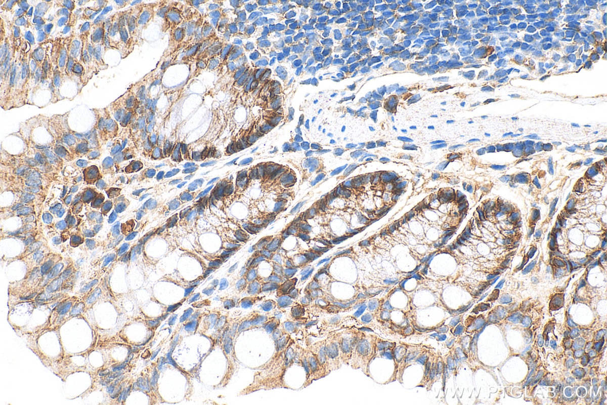 Immunohistochemical analysis of paraffin-embedded mouse colon tissue slide using 27260-1-AP (Occludin antibody) at dilution of 1:2000 (under 40x lens). Heat mediated antigen retrieval with Tris-EDTA buffer (pH 9.0). Immunohistochemistry (IHC) staining of mouse colon tissue using Occludin Polyclonal antibody (27260-1-AP)