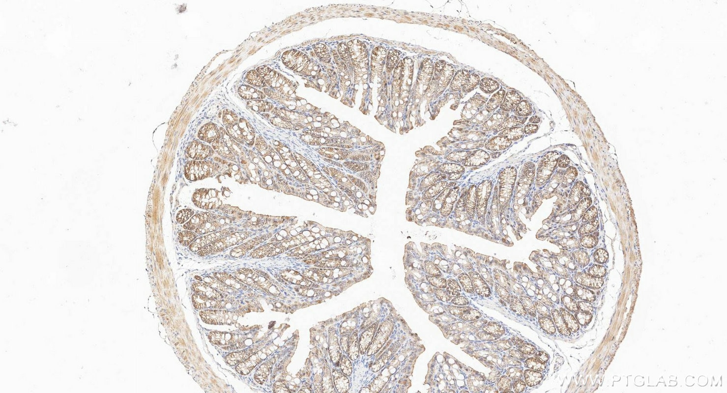 Immunohistochemistry (IHC) staining of mouse colon tissue using Occludin Polyclonal antibody (27260-1-AP)