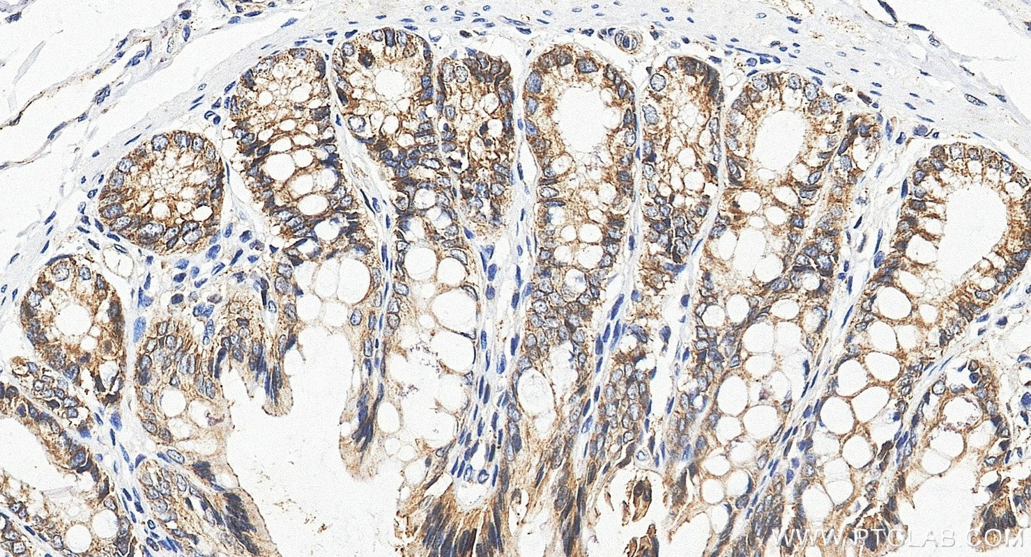 Immunohistochemistry (IHC) staining of rat colon tissue using Occludin Polyclonal antibody (27260-1-AP)