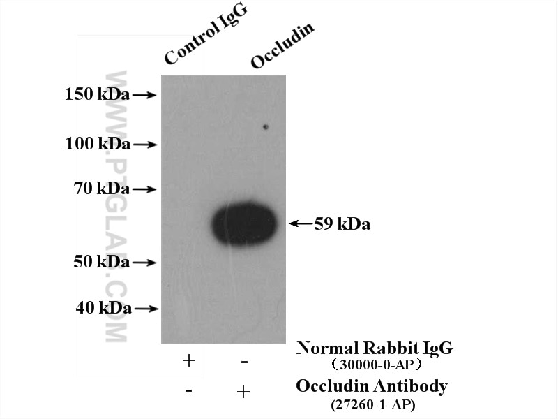 Immunoprecipitation (IP) experiment of HUVEC cells using Occludin Polyclonal antibody (27260-1-AP)