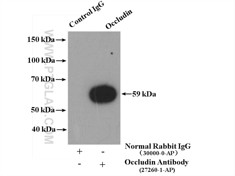 Occludin Polyclonal antibody