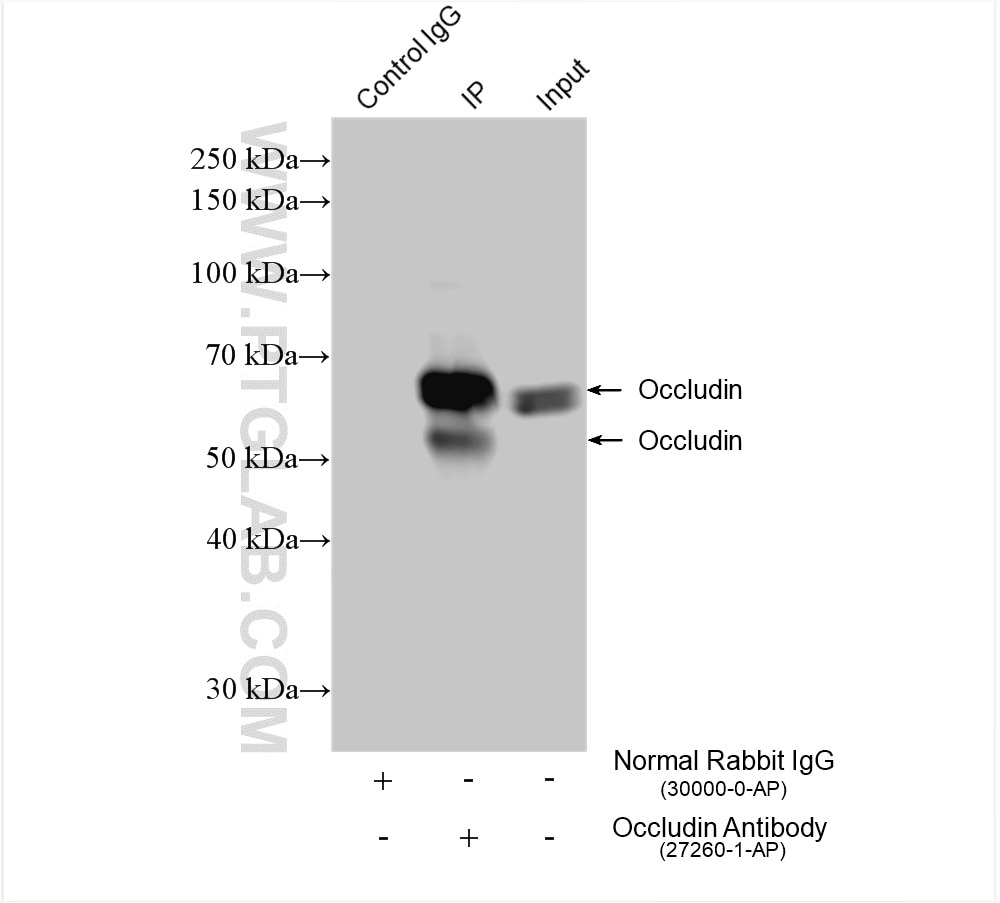 Immunoprecipitation (IP) experiment of HUVEC cells using Occludin Polyclonal antibody (27260-1-AP)
