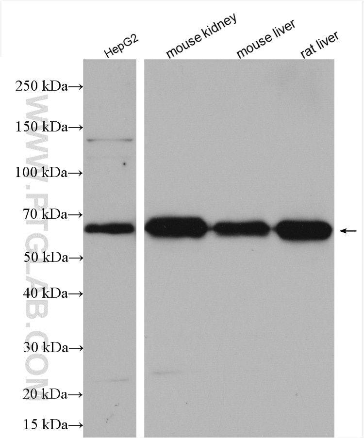 Western Blot (WB) analysis of various lysates using Occludin Polyclonal antibody (27260-1-AP)