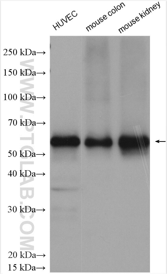 Western Blot (WB) analysis of various lysates using Occludin Polyclonal antibody (27260-1-AP)