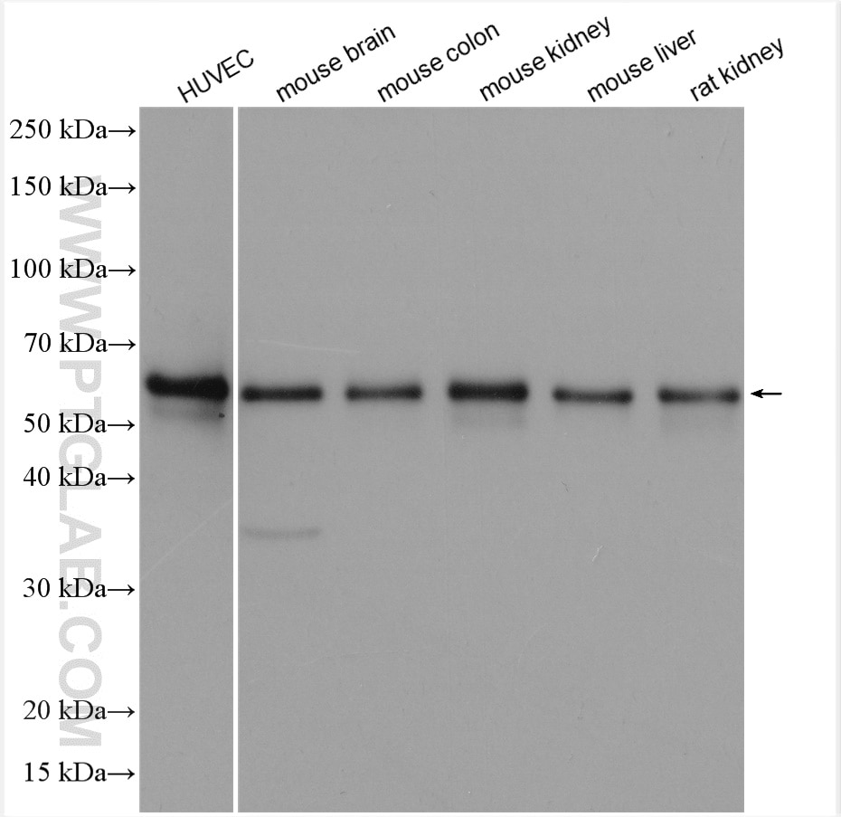 Western Blot (WB) analysis of various lysates using Occludin Polyclonal antibody (27260-1-AP)