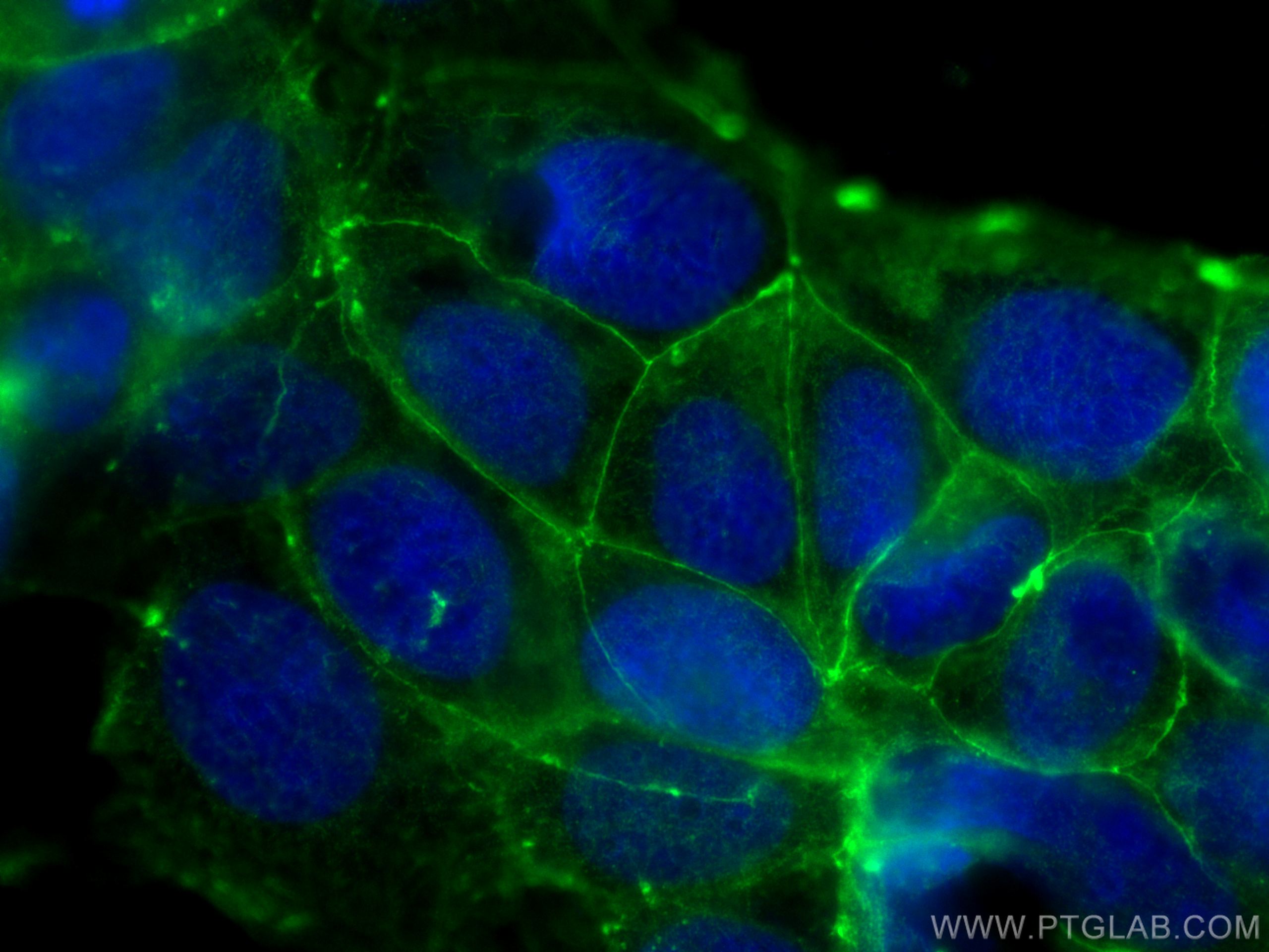 Immunofluorescence (IF) / fluorescent staining of Caco-2 cells using Occludin Monoclonal antibody (66378-1-Ig)