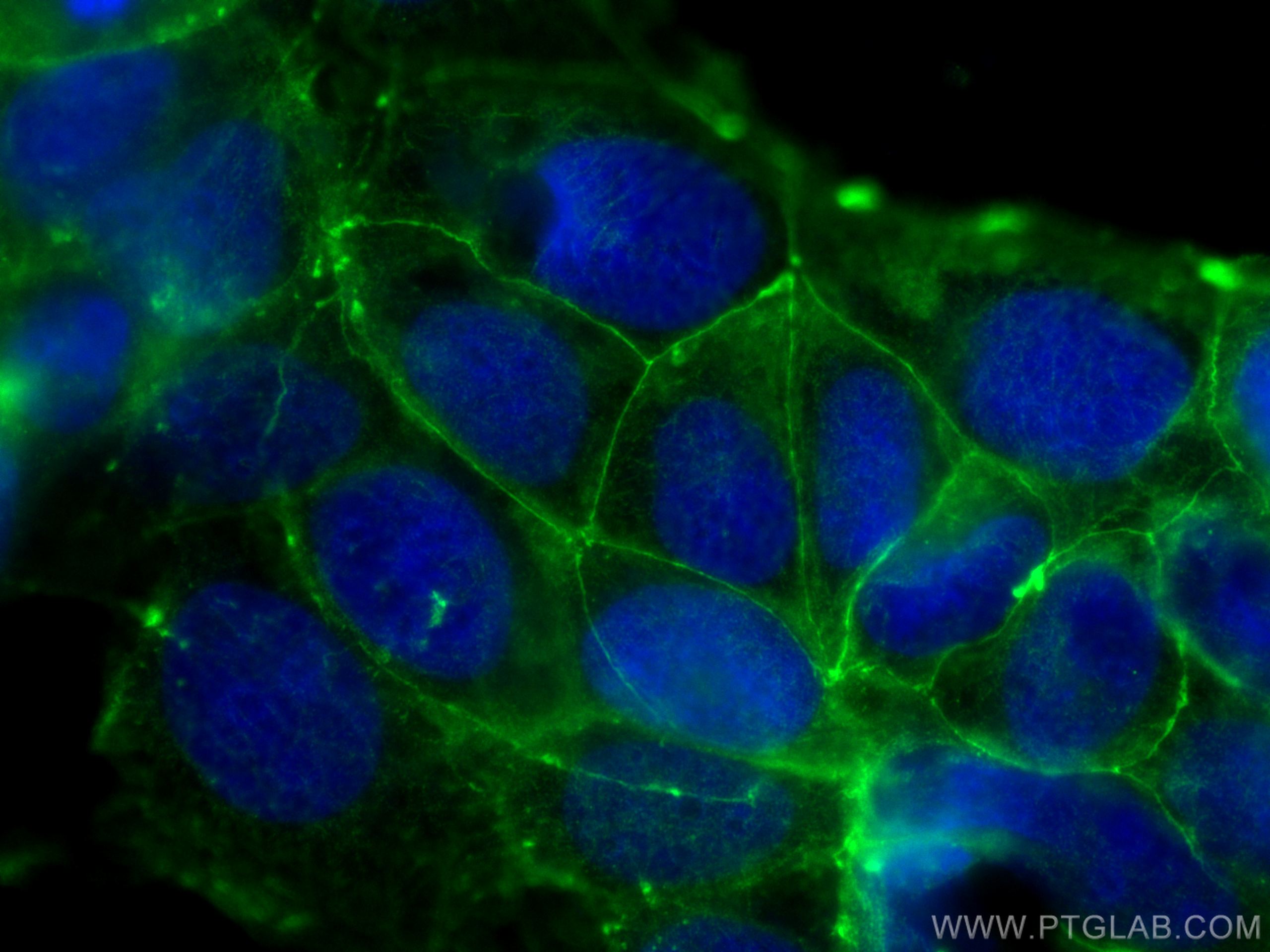 IF Staining of Caco-2 using 66378-1-Ig