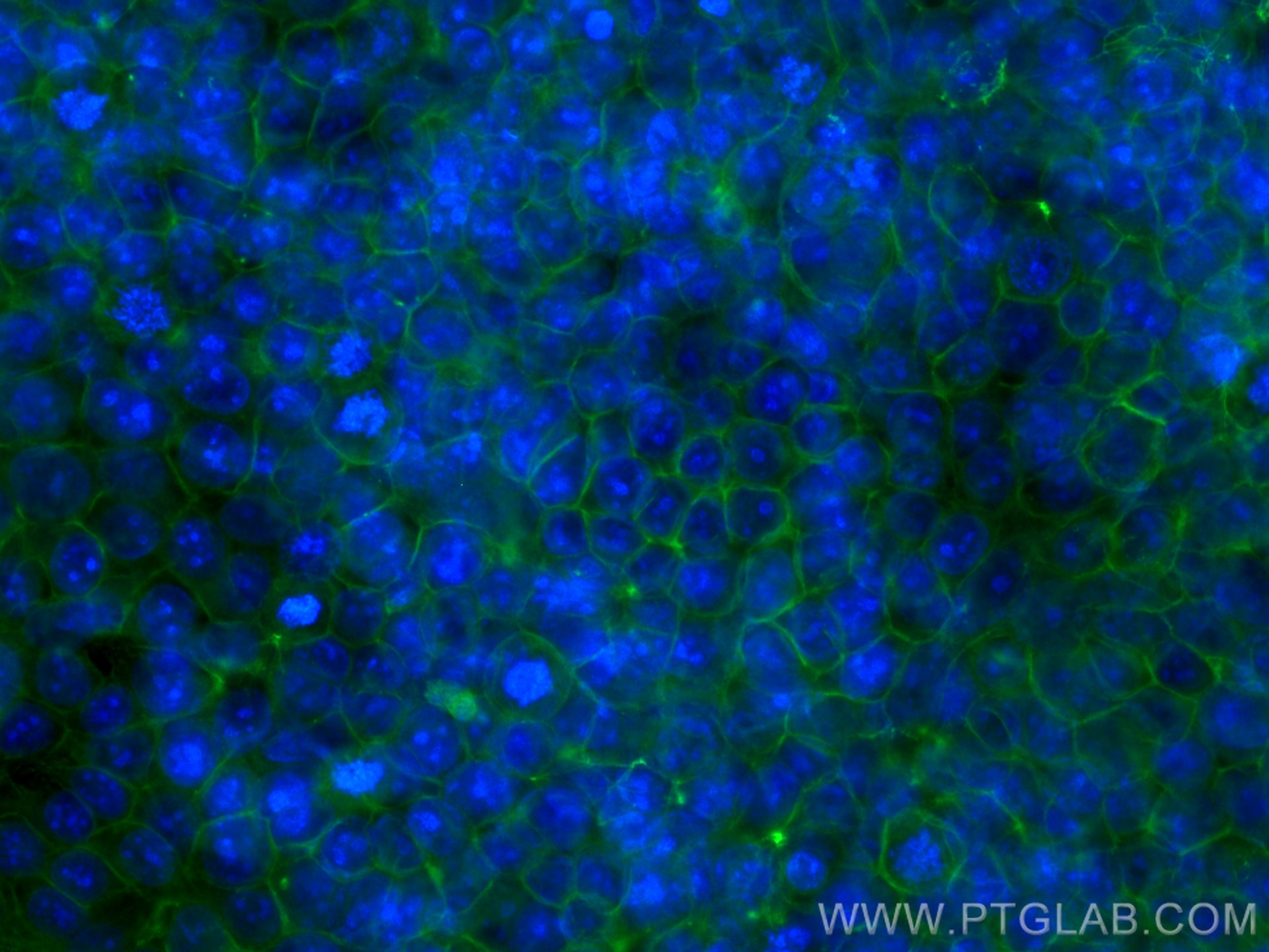 Immunofluorescence (IF) / fluorescent staining of MCF-7 cells using Occludin Monoclonal antibody (66378-1-Ig)