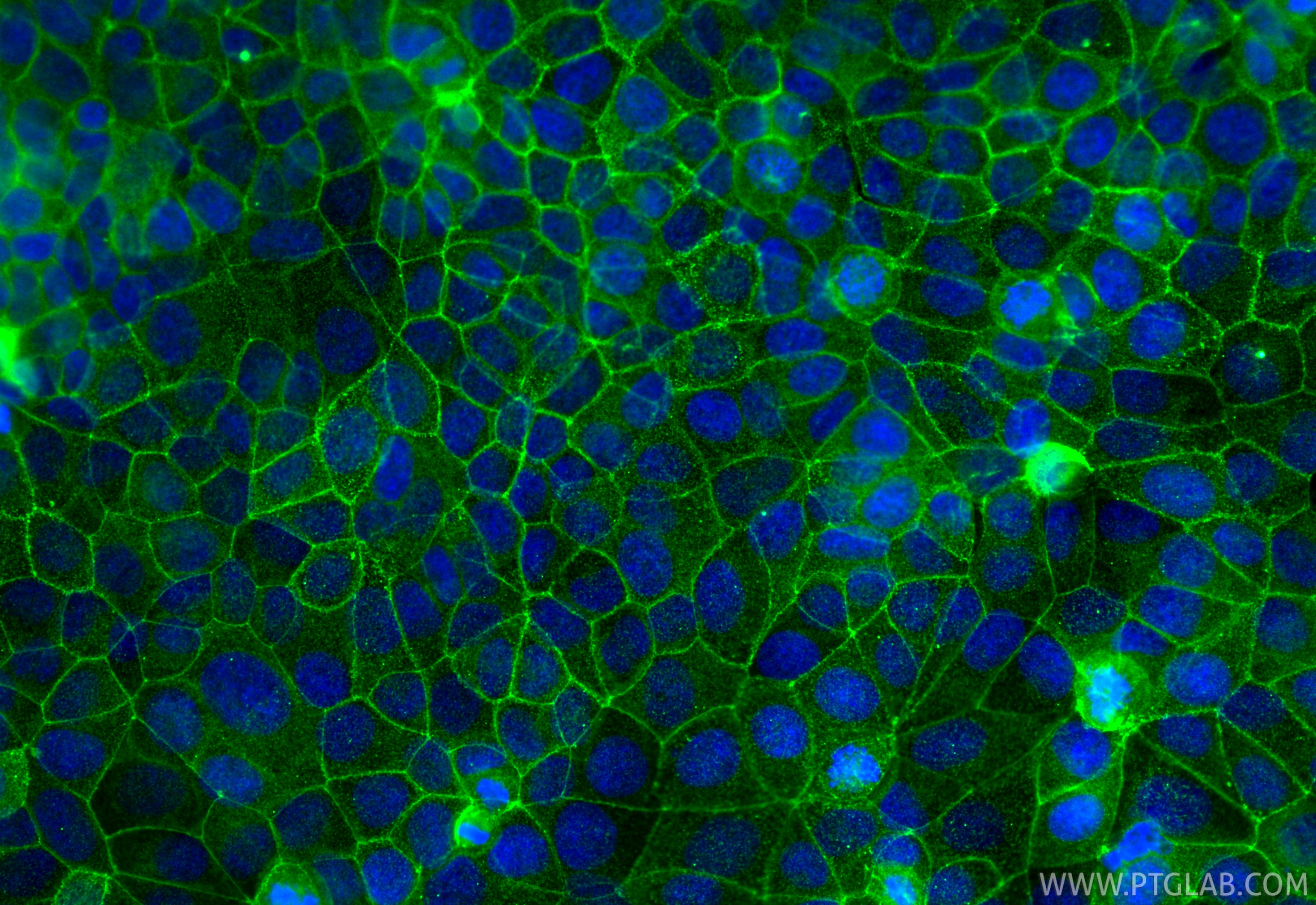 Immunofluorescence (IF) / fluorescent staining of MCF-7 cells using Occludin Monoclonal antibody (66378-1-Ig)