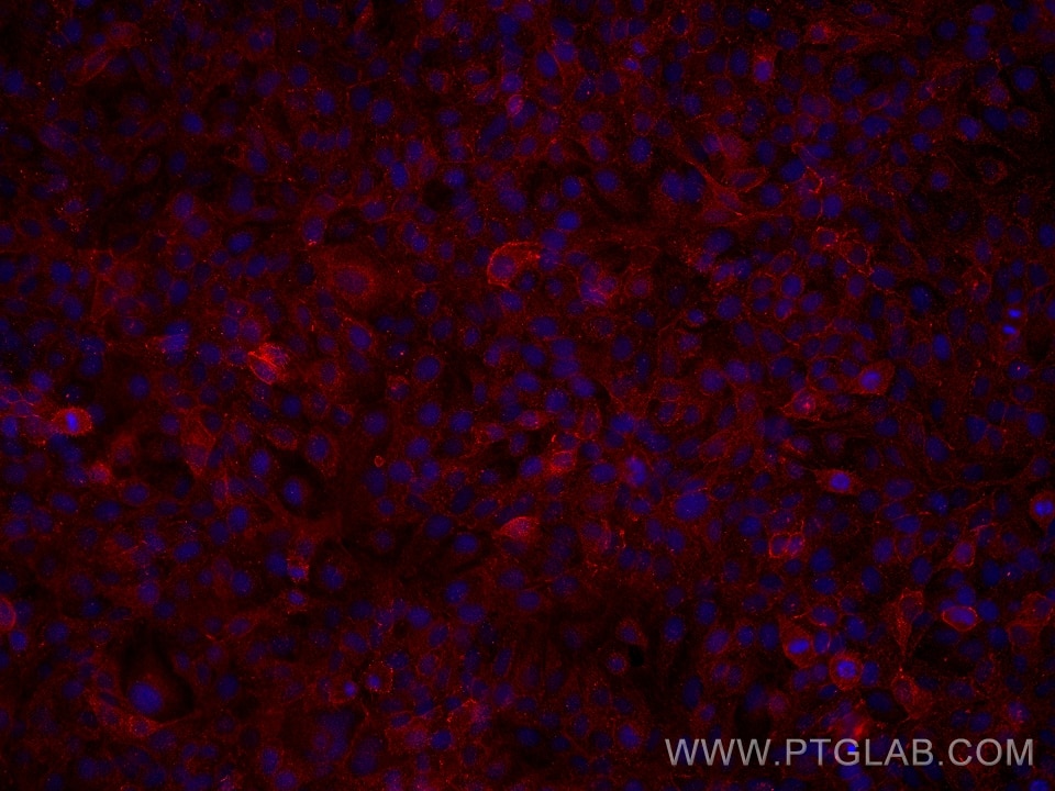Immunofluorescence (IF) / fluorescent staining of HaCaT cells using Occludin Monoclonal antibody (66378-1-Ig)