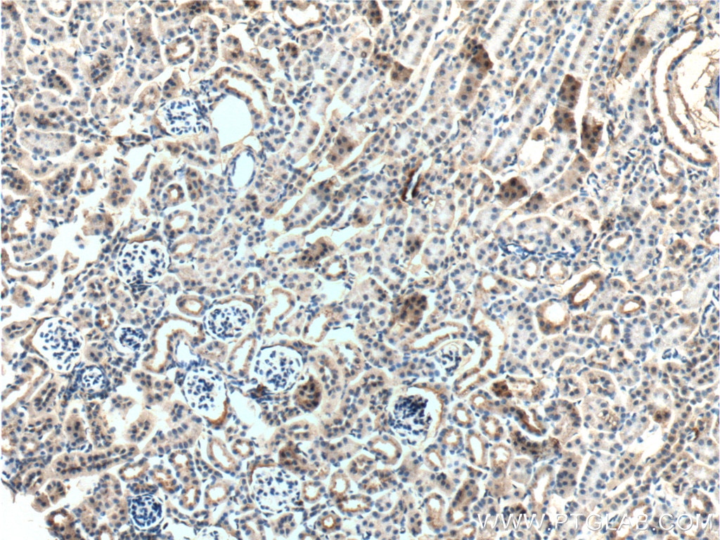 Immunohistochemistry (IHC) staining of mouse kidney tissue using Occludin Monoclonal antibody (66378-1-Ig)