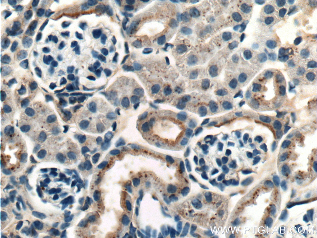 Immunohistochemistry (IHC) staining of mouse kidney tissue using Occludin Monoclonal antibody (66378-1-Ig)