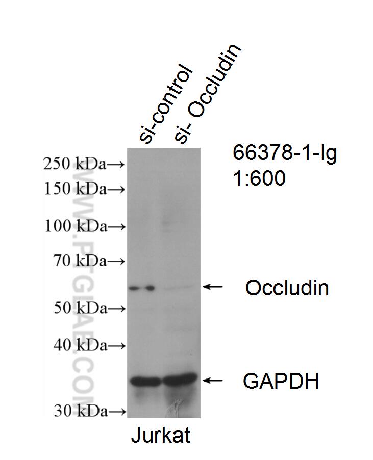 Western Blot (WB) analysis of Jurkat cells using Occludin Monoclonal antibody (66378-1-Ig)