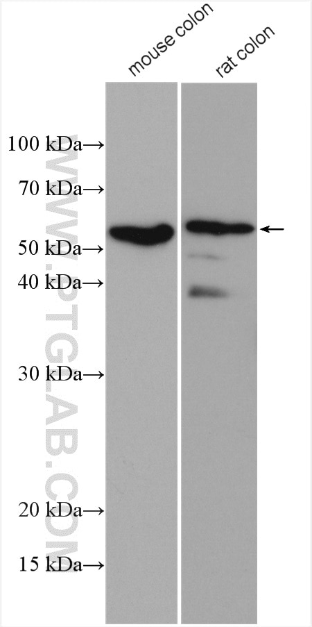 Western Blot (WB) analysis of various lysates using Occludin Monoclonal antibody (66378-1-Ig)