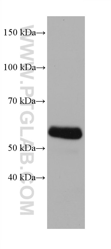 Western Blot (WB) analysis of LNCaP cells using Occludin Monoclonal antibody (66378-1-Ig)