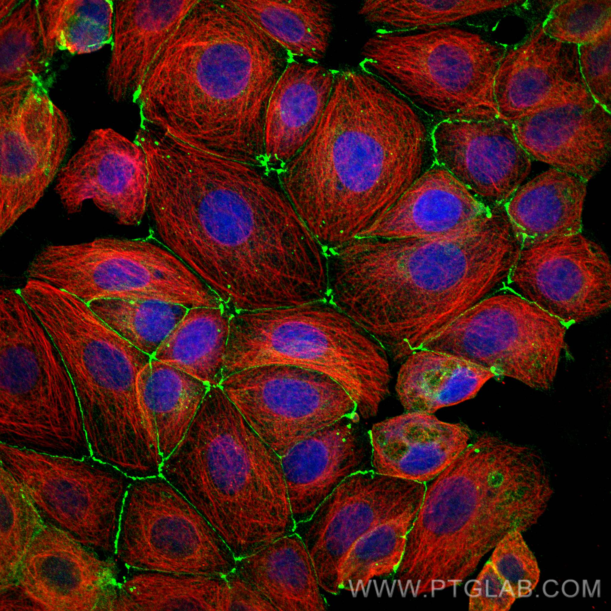 Immunofluorescence (IF) / fluorescent staining of MCF-7 cells using Occludin Recombinant antibody (80545-1-RR)