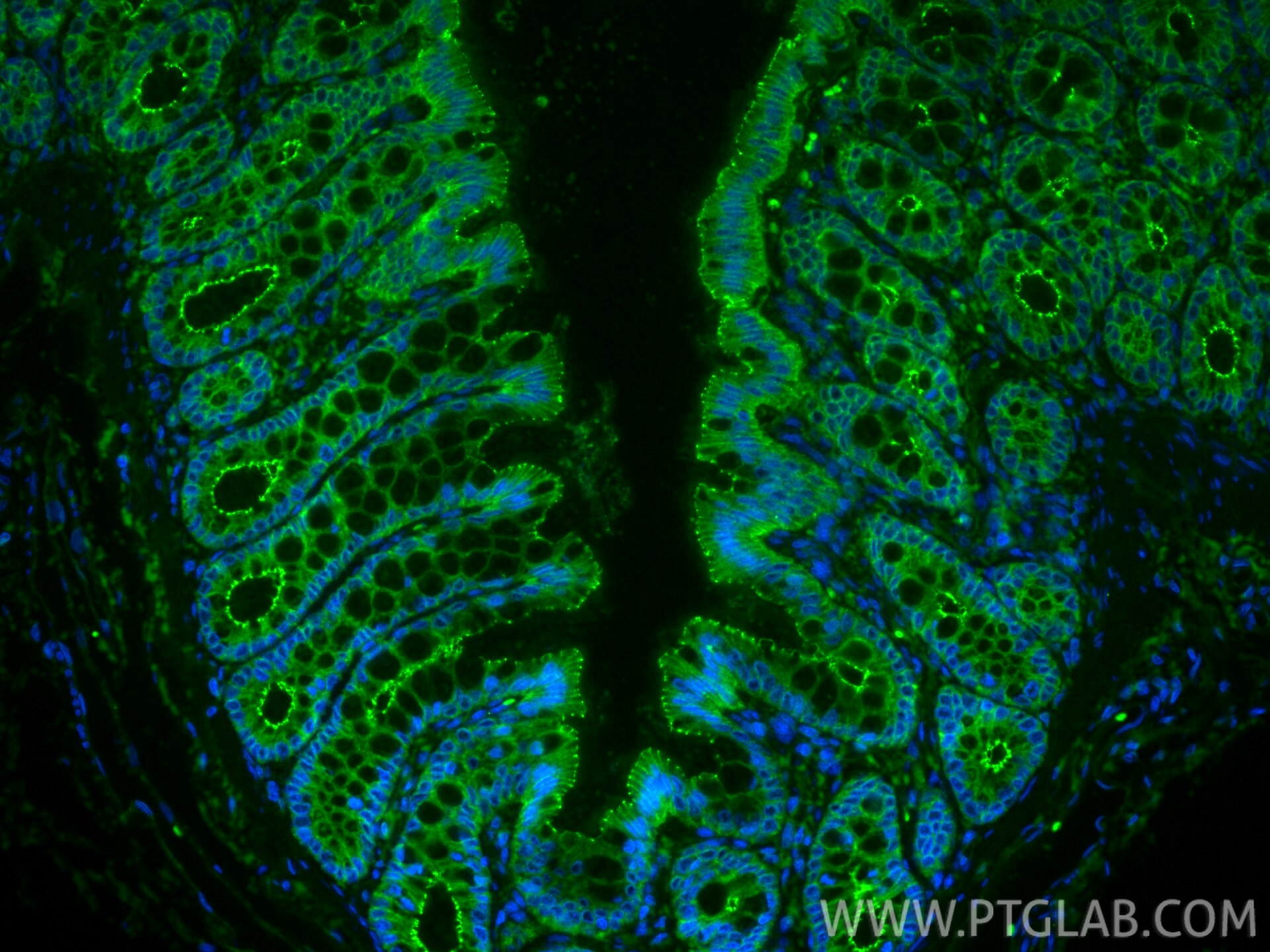 IF Staining of rat colon using 80545-1-RR Immunofluorescence (IF) / fluorescent staining of rat colon tissue using Occludin Recombinant monoclonal antibody (80545-1-RR)