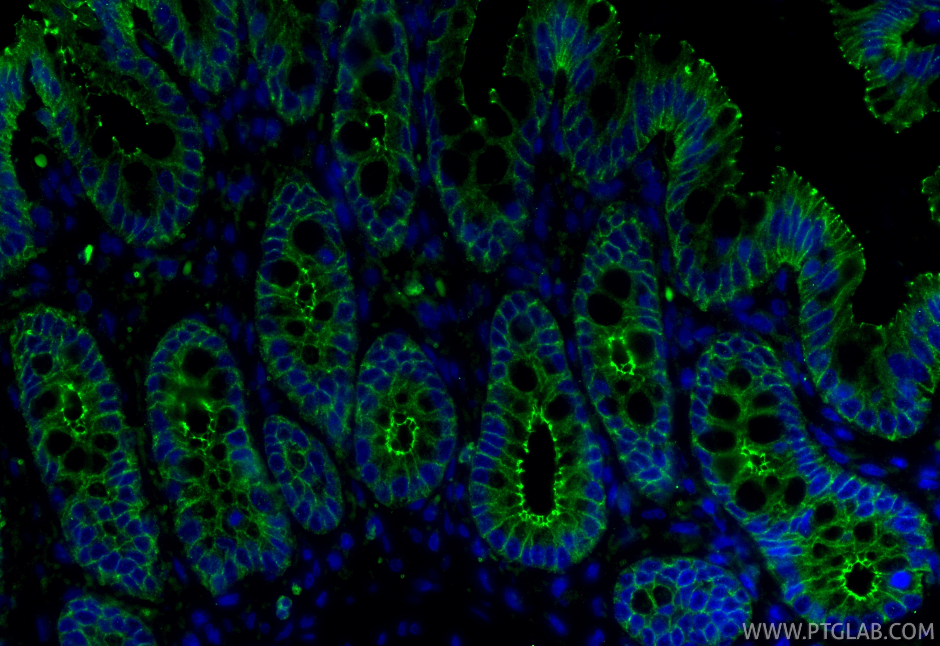 IF Staining of rat colon using 80545-1-RR Immunofluorescence (IF) / fluorescent staining of rat colon tissue using Occludin Recombinant monoclonal antibody (80545-1-RR)