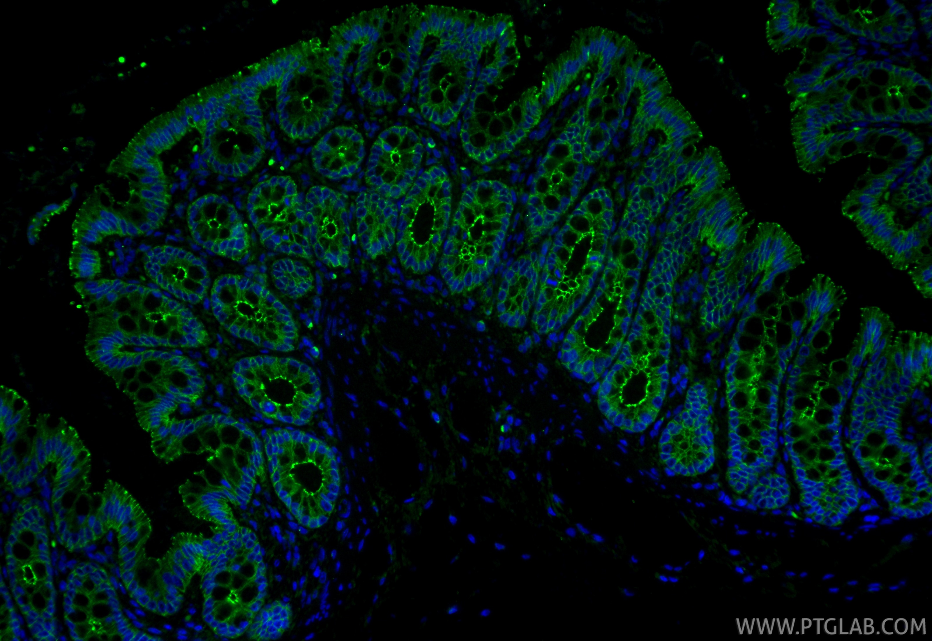 IF Staining of rat colon using 80545-1-RR Immunofluorescence (IF) / fluorescent staining of rat colon tissue using Occludin Recombinant monoclonal antibody (80545-1-RR)