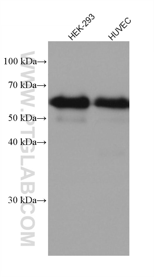 Western Blot (WB) analysis of various lysates using Occludin Recombinant antibody (80545-1-RR)
