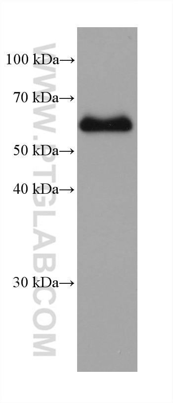 WB analysis of mouse colon using 80545-1-RR