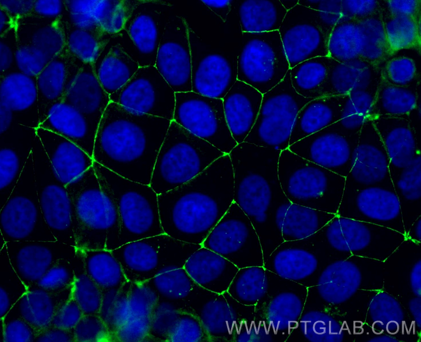 Immunofluorescence (IF) / fluorescent staining of MCF-7 cells using CoraLite® Plus 488-conjugated Occludin Polyclonal  (CL488-27260)