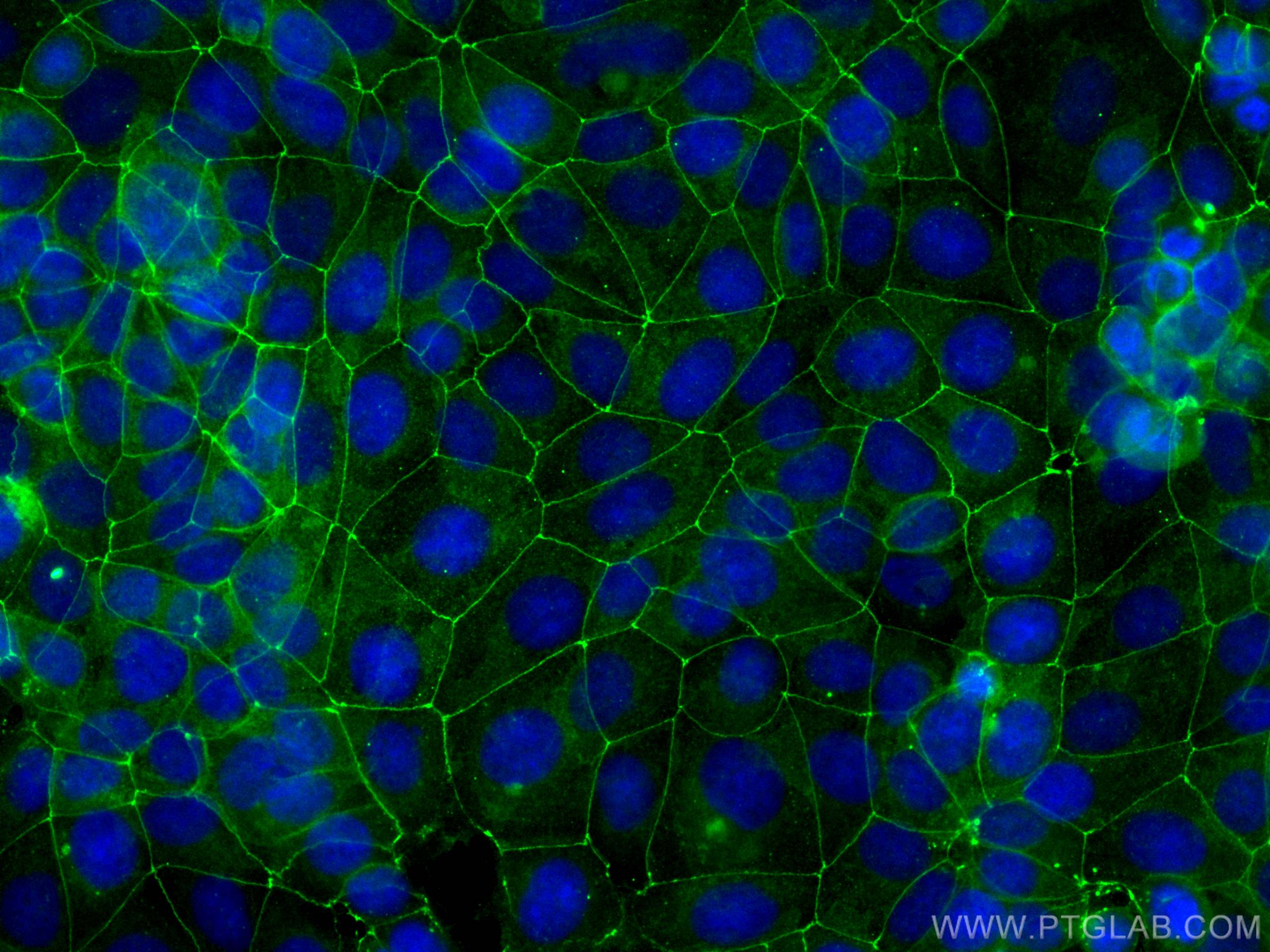 IF Staining of MCF-7 using CL488-80545