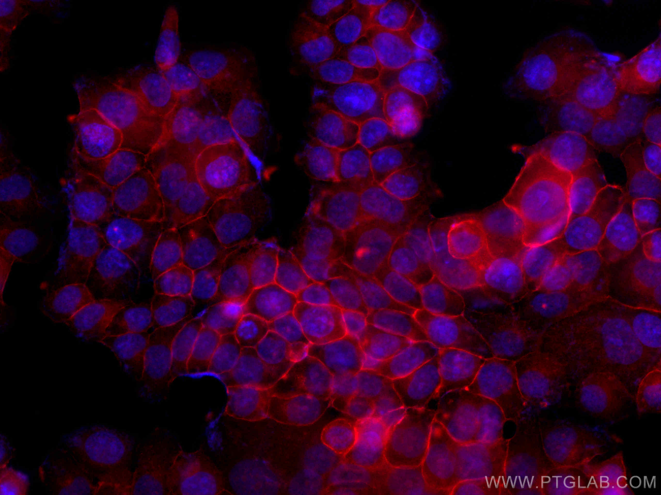 Immunofluorescence (IF) / fluorescent staining of T-47D cells using CoraLite®594-conjugated Occludin Polyclonal antibo (CL594-13409)