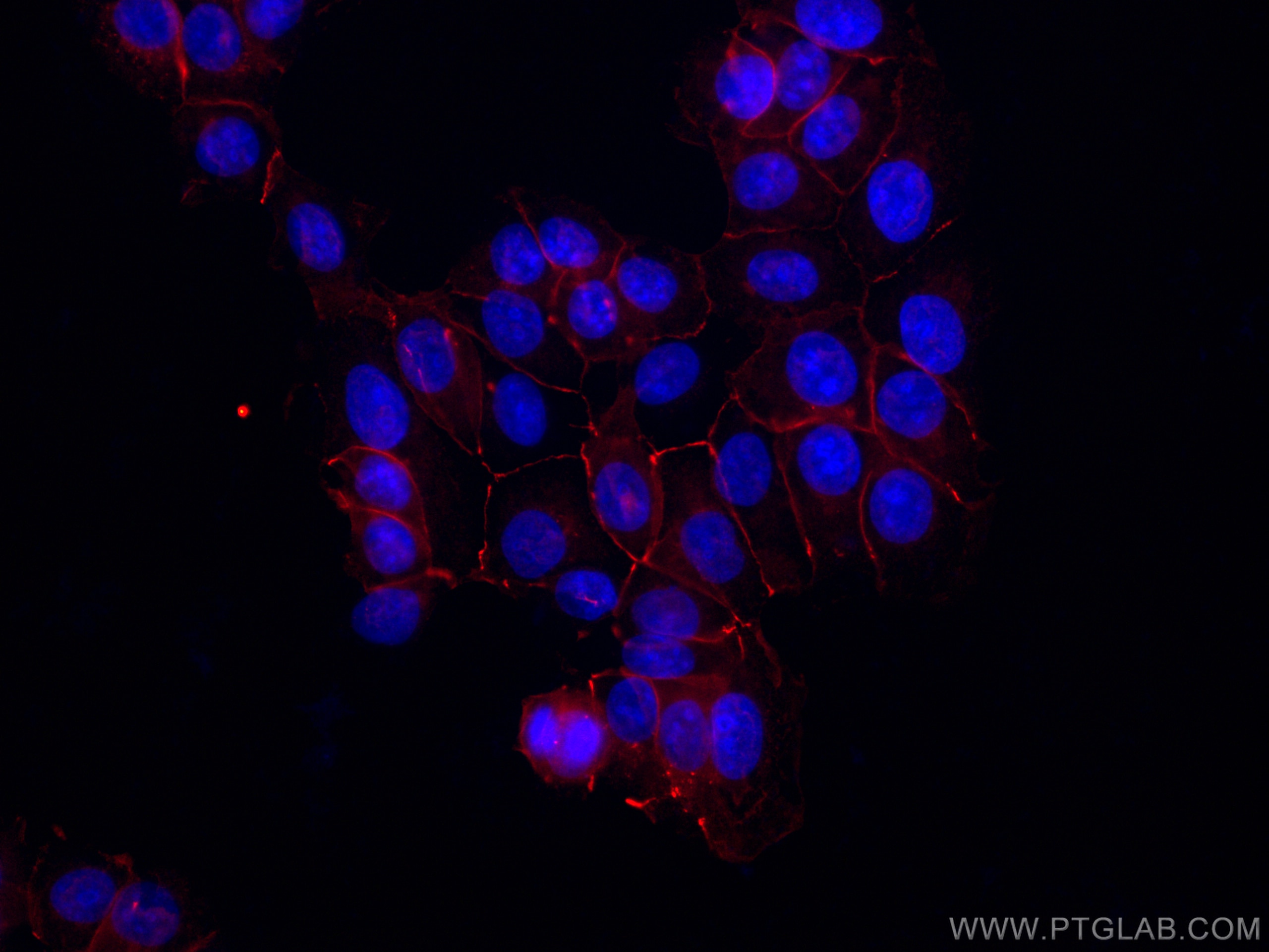 Immunofluorescence (IF) / fluorescent staining of MCF-7 cells using CoraLite®594-conjugated Occludin Polyclonal antibo (CL594-13409)