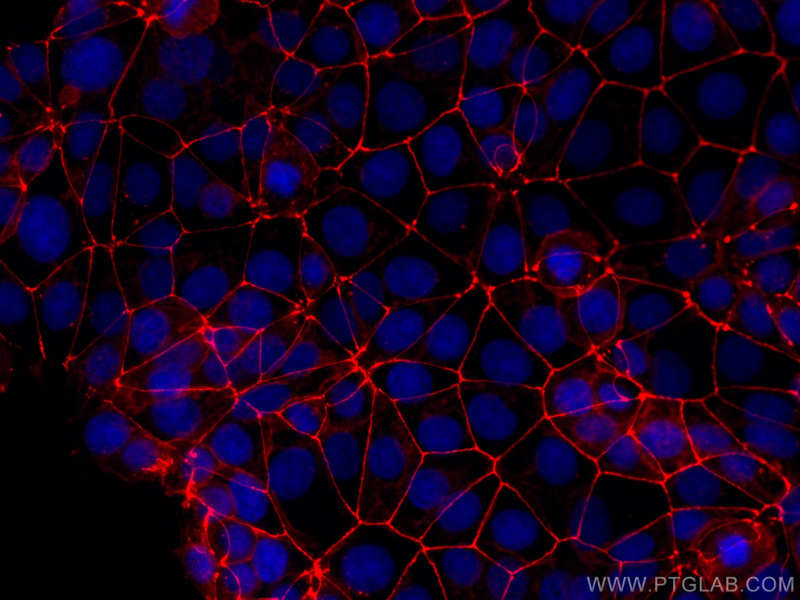 Immunofluorescence (IF) / fluorescent staining of MCF-7 cells using CoraLite®594-conjugated Occludin Polyclonal antibo (CL594-27260)