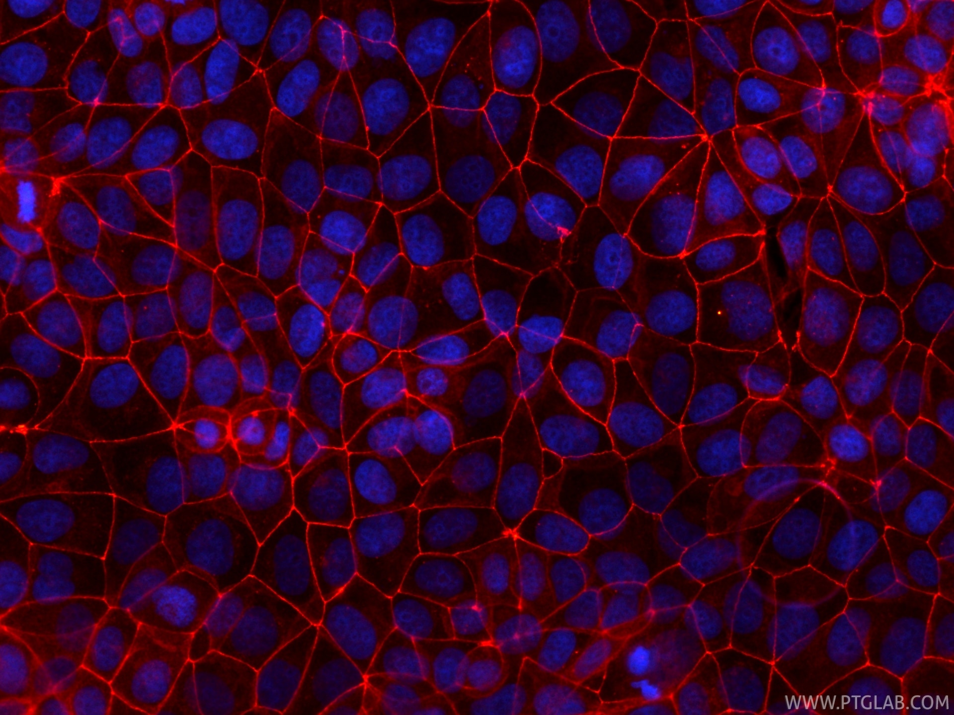 Immunofluorescence (IF) / fluorescent staining of MCF-7 cells using CoraLite®594-conjugated Occludin Recombinant monoc (CL594-80545)