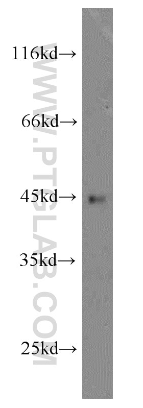 Western Blot (WB) analysis of human spleen tissue using ORAI1 Polyclonal antibody (14443-1-AP)