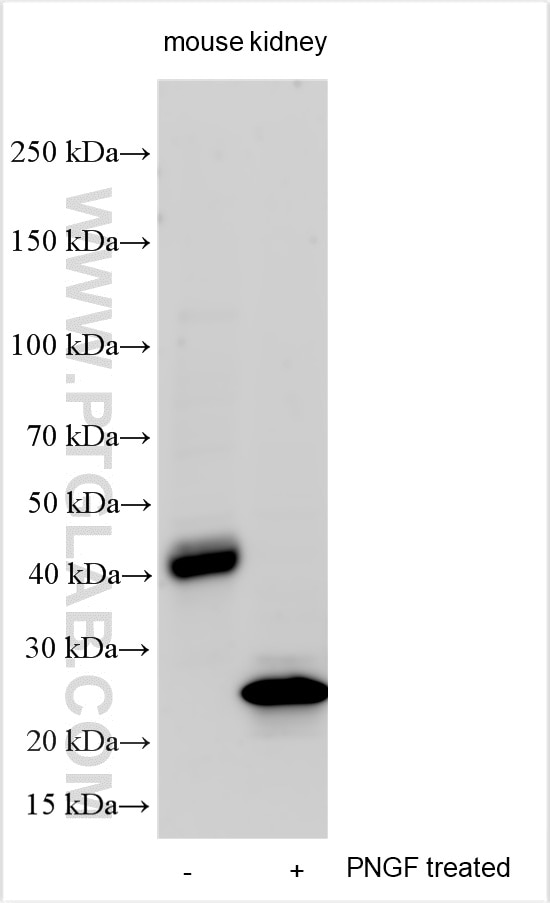 Western Blot (WB) analysis of various lysates using Orm1 Polyclonal antibody (32498-1-AP)