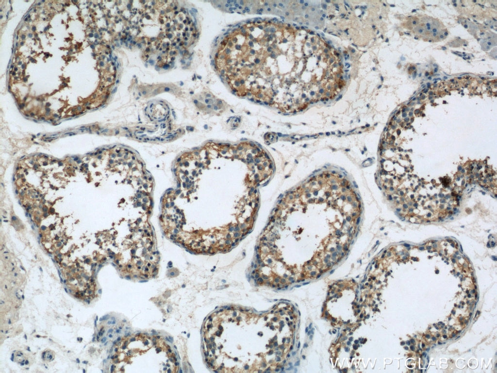 IHC staining of human testis using 23418-1-AP