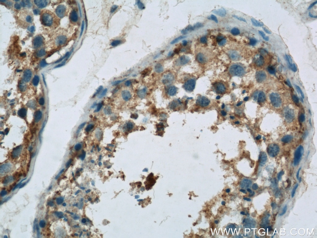 Immunohistochemistry (IHC) staining of human testis tissue using Osteocalcin Polyclonal antibody (23418-1-AP)